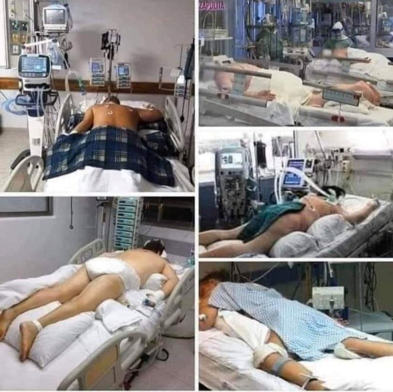 Pogledajte za šta tačno služe RESPIRATORI i koju odgovornost predstavljaju kod pacijenta zaraženim sa virusom COVID-19! Pogledajte za šta tačno služe RESPIRATORI i koju odgovornost predstavljaju kod pacijenta zaraženim sa virusom COVID-19!