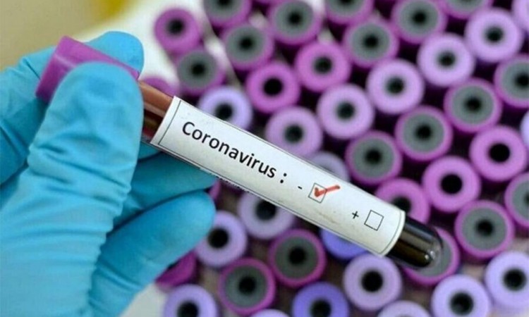 U FBiH u protekla 24 sata 42 novozaražene osobe koronavirusom