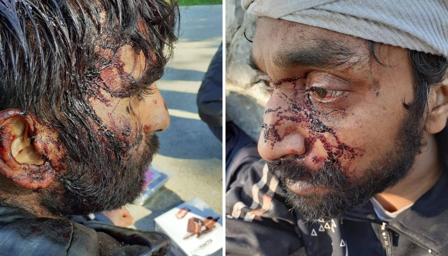 Amnesty tvrdi: ‘Hrvatska je policija tukla migrante, mazali su im majonezu i kečap po kosi’