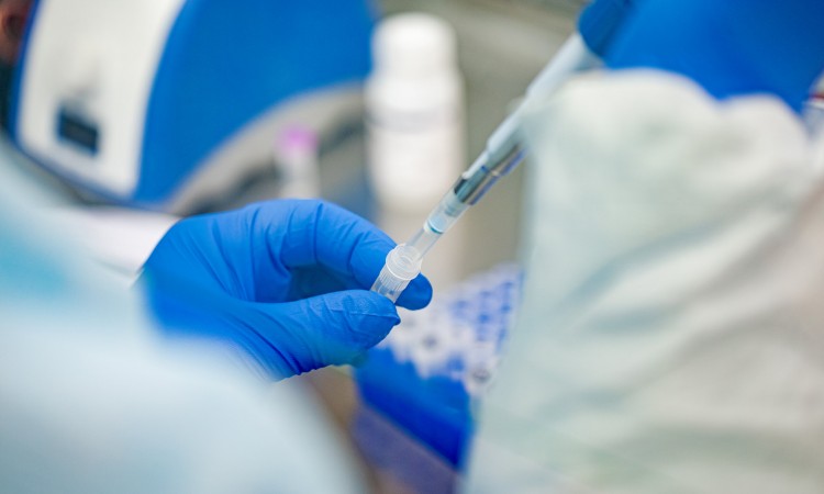 Novih 309 slučajeva zaraze koronavirusom u FBiH, šest osoba preminulo