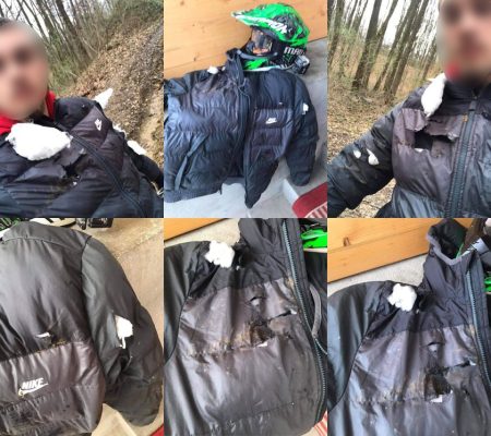 Mladom motociklisti iz Brčko distrikta postavljena bodljikava žica umalo prerezala vrat !