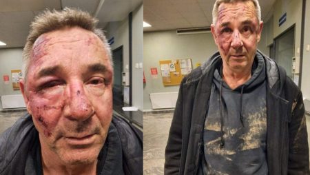 Kadir Hajdarević: Suad Žilić pretučen je od strane pripadnika policijske uprave Tuzla!