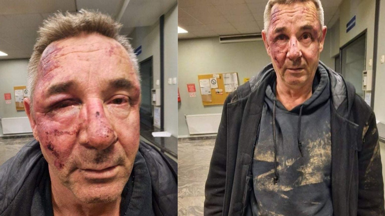 Kadir Hajdarević: Suad Žilić pretučen je od strane pripadnika policijske uprave Tuzla!