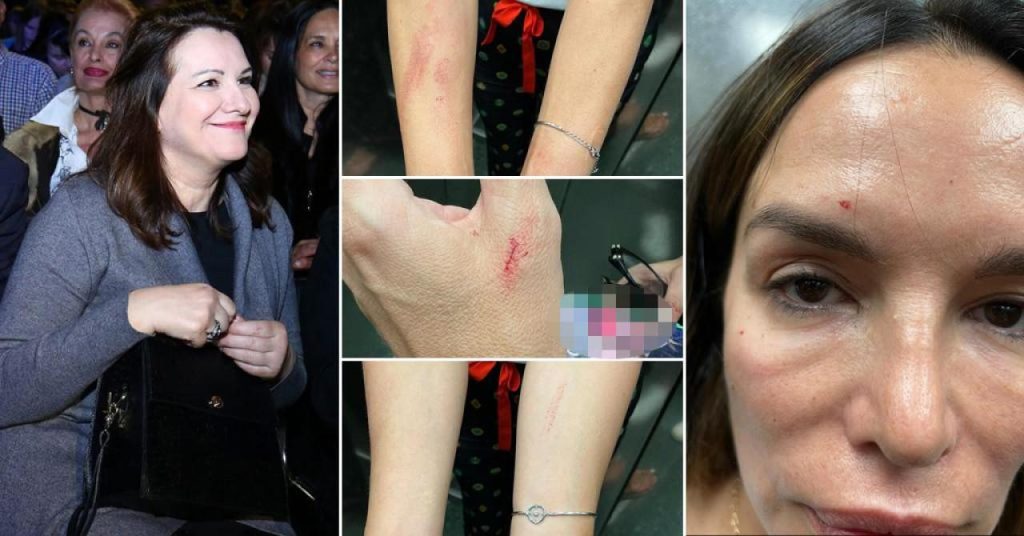 Policija privela Severinu, izvor blizak pjevačici: ‘Sestra ju je napala i lažno prijavila‘