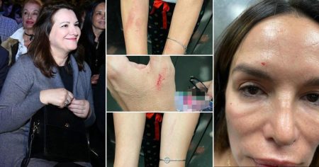 Policija privela Severinu, izvor blizak pjevačici: ‘Sestra ju je napala i lažno prijavila‘