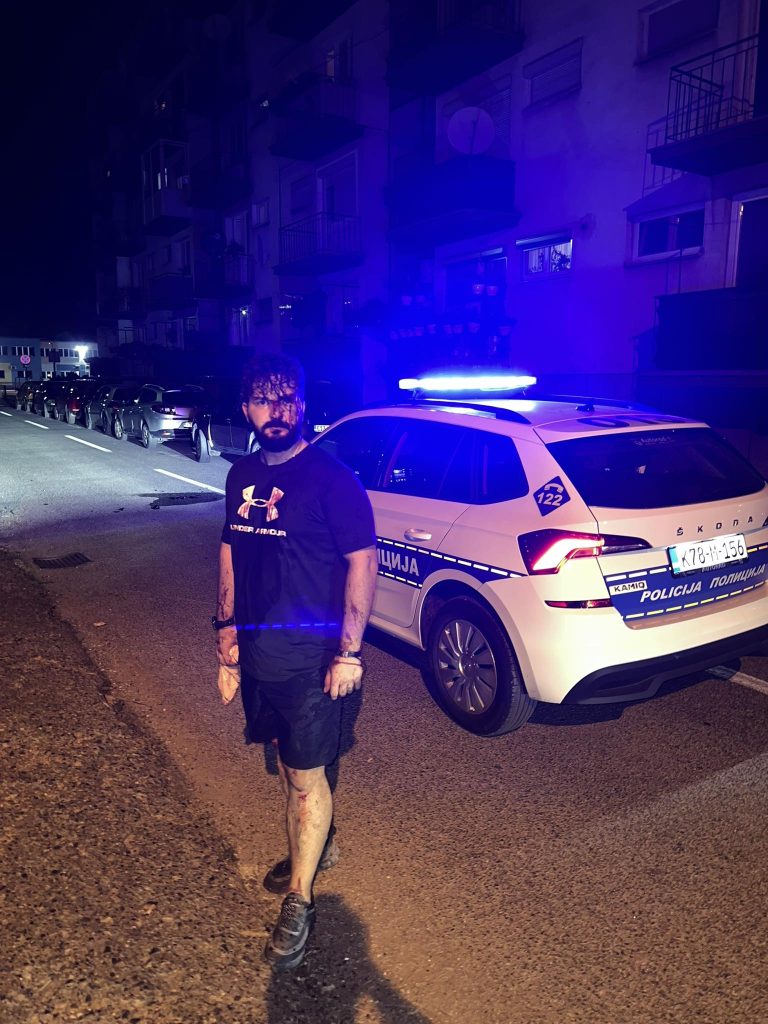 Uhapšen jedan od napadača na Mirzu Dervišća Uhapšen jedan od napadača na Mirzu Dervišća