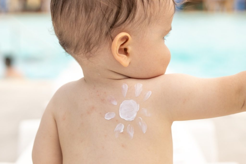 Alergije na sunce – vrste, terapija i prevencija
