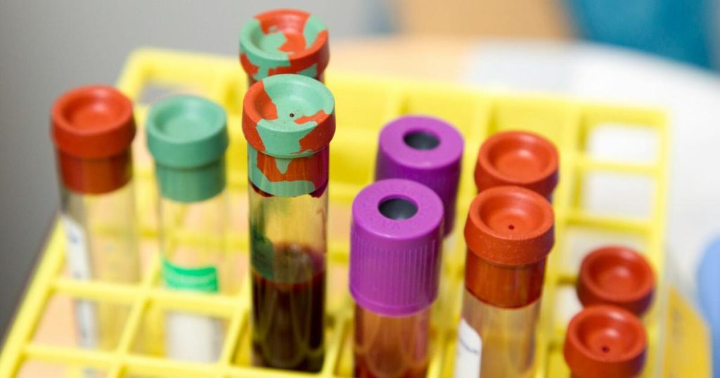 Znanstvenici identificirali novu krvnu grupu: Veliki misterij razriješen nakon 50 godina