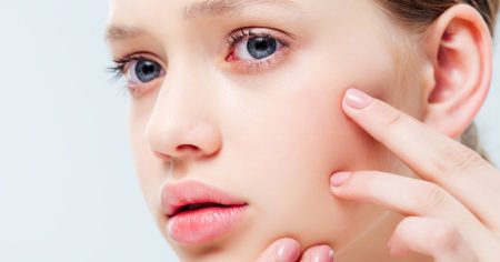 4 trika da ih “uklonite” sa lica