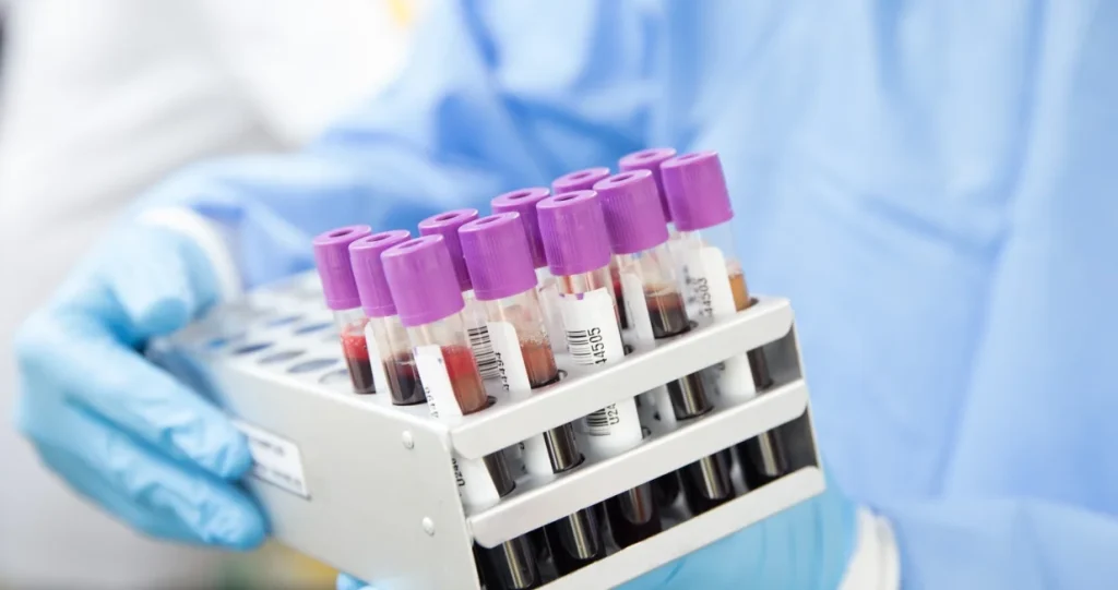 Samo 50 ljudi na svijetu ima zlatnu krv, naučnici pokušavaju da ih kloniraju