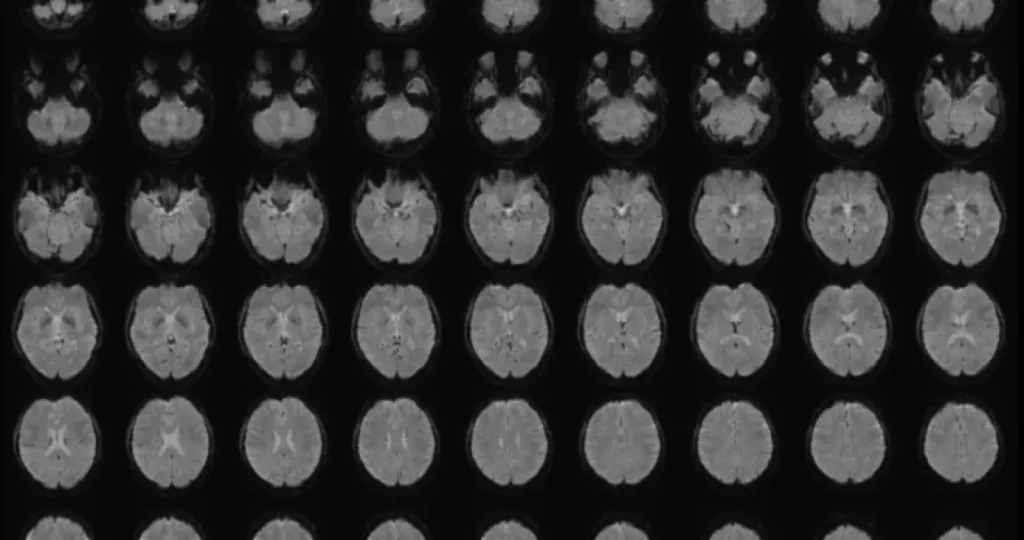 AI i pitanje mentalne privatnosti: Da li će vještačka inteligencija uskoro moći čitati naše misli?