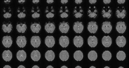 AI i pitanje mentalne privatnosti: Da li će vještačka inteligencija uskoro moći čitati naše misli?