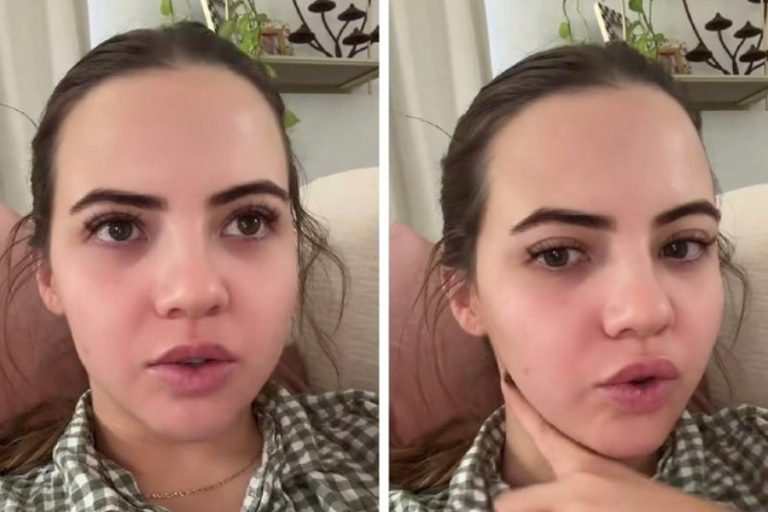 DVA PUTA PONOVILA ISTU GREŠKU: Influencerica pokazala posljedice koje ima od botoksa (VIDEO)