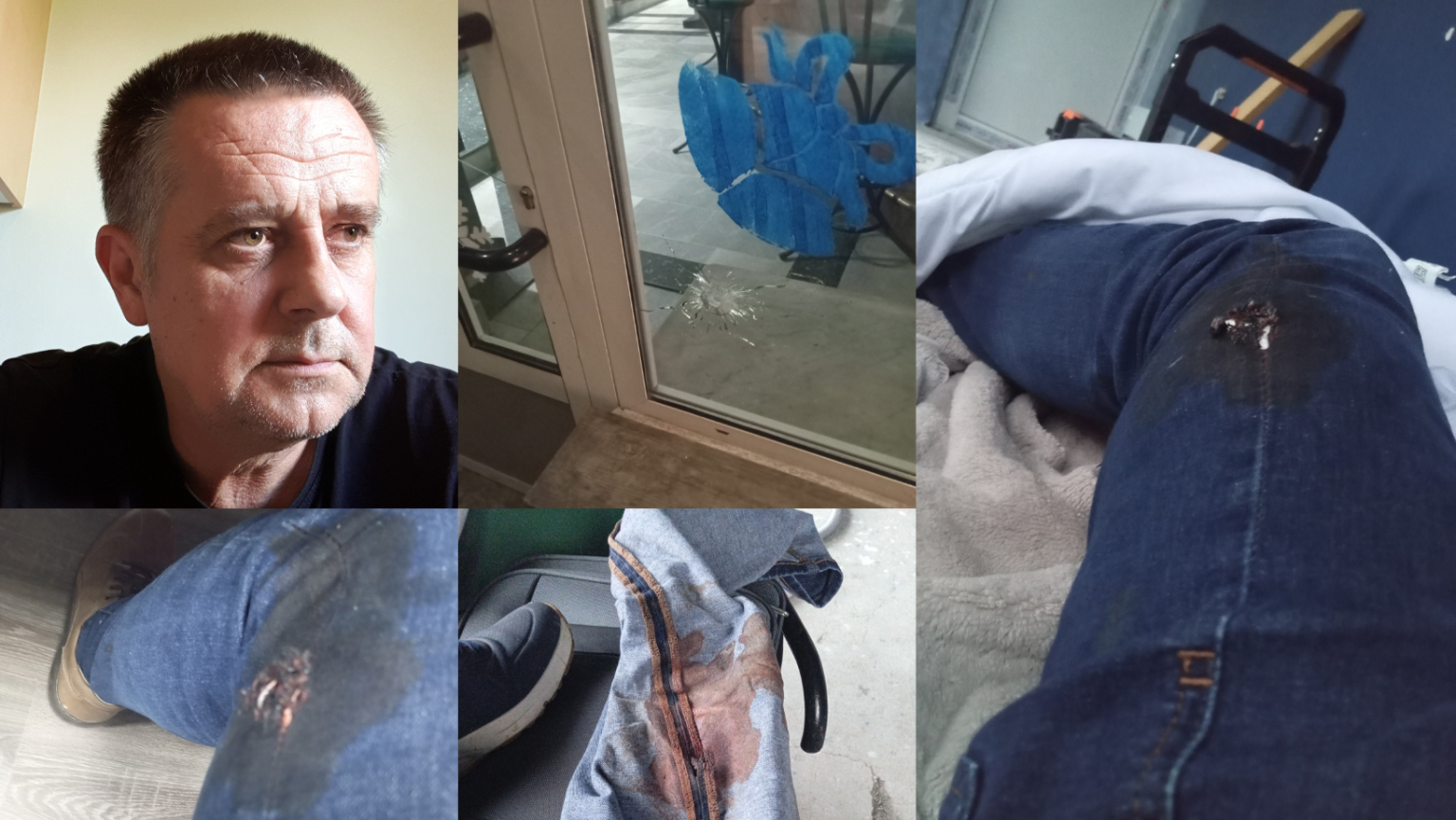 Pokušaj likvidacije u Brčko distriktu BiH: Blaško Lovrić Baja ranjen, heroj iz kafane stao ispred pištolja i rekao “Hajde pucaj u mene” – JZU BD BIH odmah ispostavila račun od 90 KM nakon ukazivanja pomoći ranjeniku…