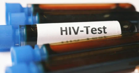 Nijemci otkrili novo antitijelo protiv HIV-a