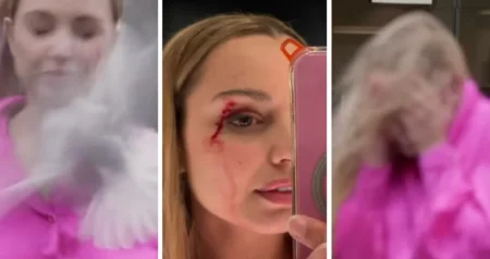 (VIDEO) Reporterku tokom snimanja napao galeb: Završila sa krvavom glavom