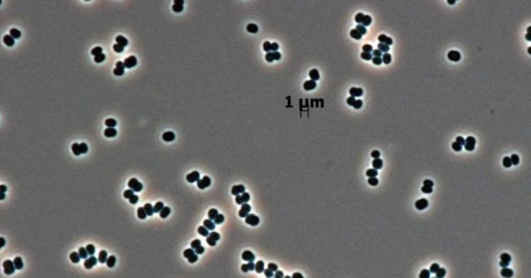 Jesmo li nehotice poslali bakteriju na Mars? Jesmo li nehotice poslali bakteriju na Mars?