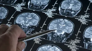 Ova misteriozna bolest je ubila pola miliona ljudi i onda samo nestala: Njen povratak je moguć Ova misteriozna bolest je ubila pola miliona ljudi i onda samo nestala: Njen povratak je moguć