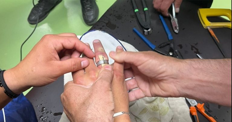 Neobična intervencija: Prijedorski vatrogasci skinuli mu prsten sa ruke (FOTO)
